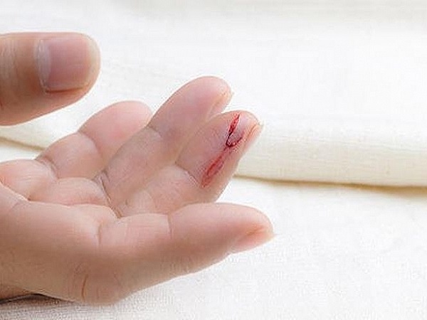 Nằm mơ thấy chảy máu đánh con gì may mắn dễ trúng